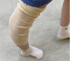 소아마비보조기 티솔…